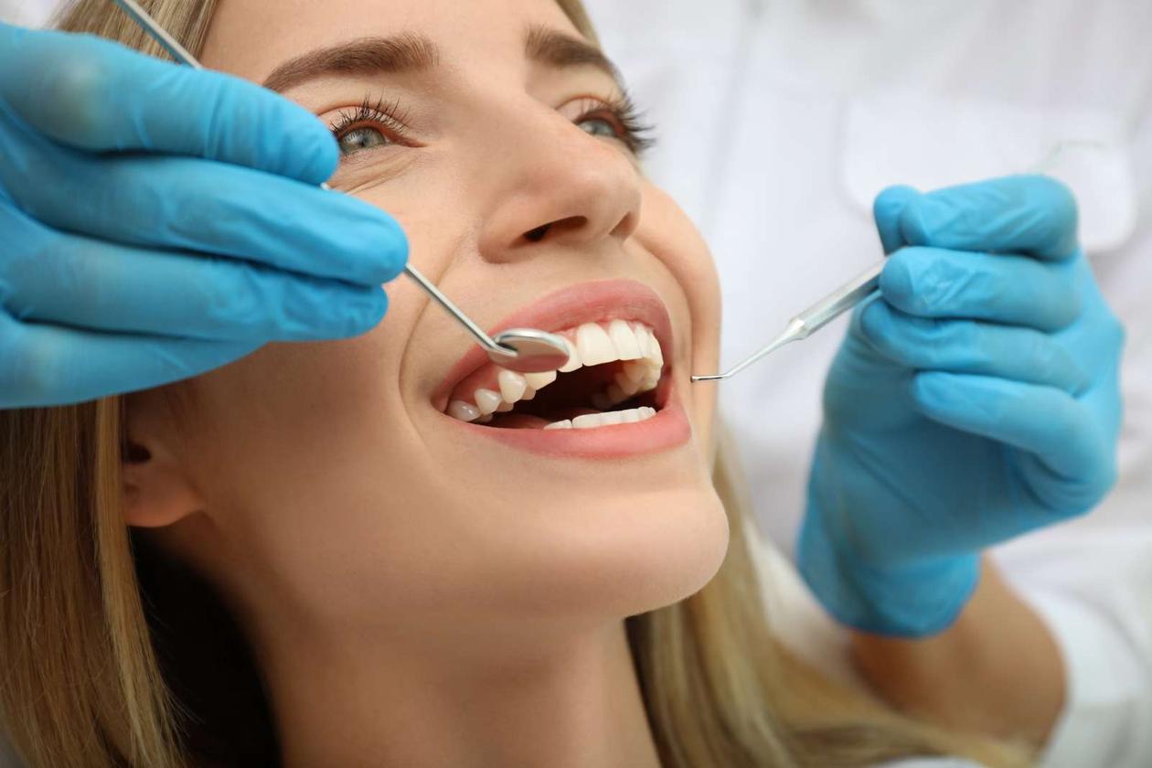 Composite Bonding Widnes | About Smiles Dentistry