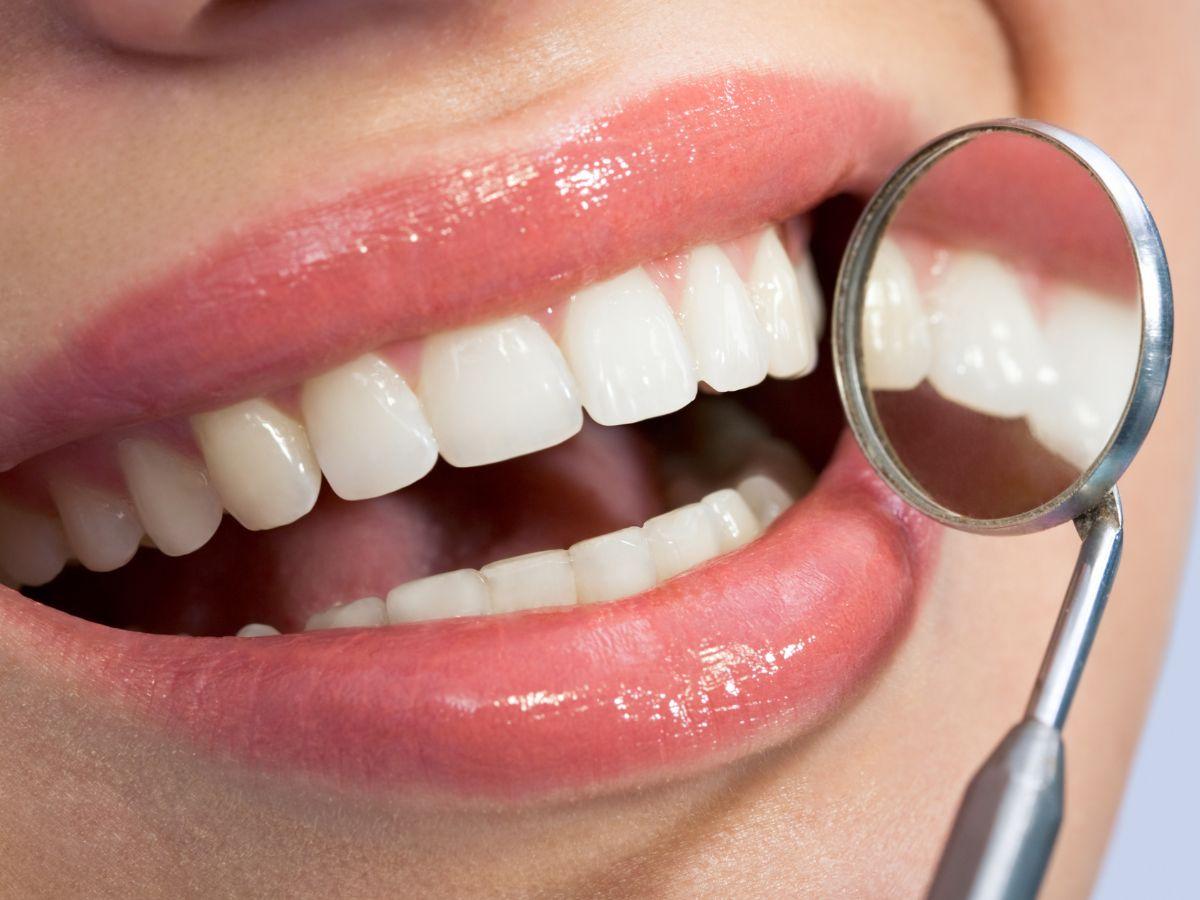 About Smiles Composite Bonding Supporting Your Smile