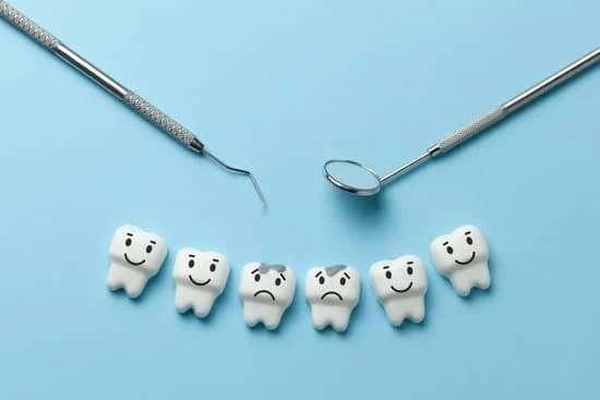 White Fillings Widnes